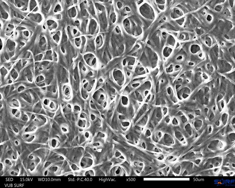 nc-hyphae-500x_1_aurelie-van-wylick-micr_low.jpg